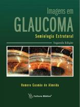 Imagens Em Glaucoma Semiologia Estrutural - Cultura Médica
