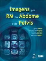 Imagens por Rm do Abdome e da Pelvis