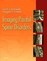 Imaging painful spine disorders - Elsevier (import)