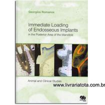 IMMEDIATE LOADING OF ENDOSSEOUS IMPLANTS -