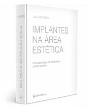 Implantes Na Área Estética Uma Estratégia De Tratamento Passo-A-Passo - Editora Napoleão Implantes Na Área Estética Uma Estratégia De Tratamento Passo-A-Passo - Editora Napoleão