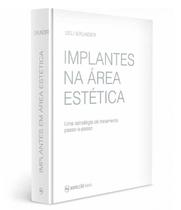 Implantes Na Área Estética – Uma Estratégia De Tratamento Passo-A-Passo - Editora Napoleão