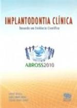 Implantodontia Clínica: Baseada Em Evidência Científica - ABROSS - 2010 - QUINTESSENCE Implantodontia Clínica: Baseada Em Evidência Científica - ABROSS - 2010 - QUINTESSENCE
