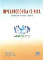 Implantodontia clinica: baseada em evidencia cientifica - QUINTESSENCE
