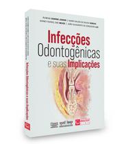 Infecções odontogênicas e suas implicações - Editora Doctor Livros