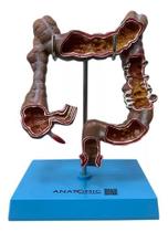 Intestino Humano Grosso Colon Ascendente Descendente E Reto