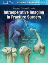 Intraoperative imaging in orthopaedic trauma: illustrated tips and tricks