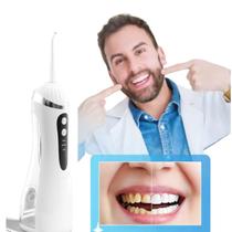 Irrigador Oral Bucal Jato Limpador De Prótese Fixa Protocolo Aparelho Ortodôntico e Implantes Dentarios Jato Forte Irrigador Oral Bucal Jato Limpador De Prótese Fixa Protocolo Aparelho Ortodôntico e Implantes Dentarios Jato Forte