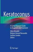 Keratoconus