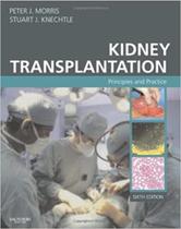 Kidney transplantation. principles and practice - W.B. SAUNDERS