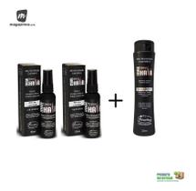Kit 2 Tonico Max Hair + 1 Shampoo Max Hair Trat. Calvície