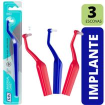 KIT 3 Escovas Dentais para implantes -Tepe Universal Care