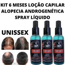 Kit 3 Loção Spray Anti Caspa E Queda Fortalece Bulbo Capilar