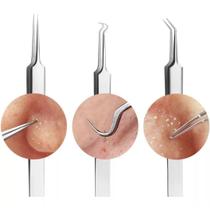 Kit 3 Pinças Tweezenrs Extrator Cureta Removedor De Cravos