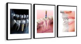Kit 3 Quadros Decorativos Odontologia Consultório Dentistas 60x40 Vinil