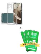 Kit 3UN Película de Cerâmica Protetora + Capinha Anti Choque TPU para Moto G86 5G
