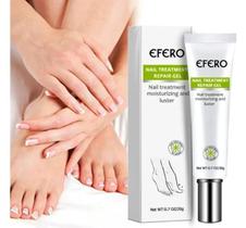 Kit 4 Pomadas Para Tratamento De Unhas