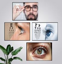 Kit 4 Quadros Ótica Exame Vista Óculos Oftalmologia Clínica