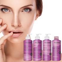 Kit Anti-Manchas Tratamento Facial Skincare Efeito Peeling Clareador da Pele - Rhenuks Kit Anti-Manchas Tratamento Facial Skincare Efeito Peeling Clareador da Pele - Rhenuks