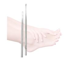 Kit bisturis desencravador goiva e para calosidade plantar Kit bisturis desencravador goiva e para calosidade plantar