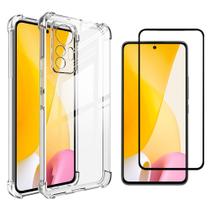 Kit Capa Capinha Para Xiaomi 12 Lite Anti Impacto + Película