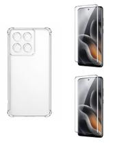 Kit Capa Tpu + 2 UN Película Curvada 3d Para Moto Edge 70 Fusion Kit Capa Tpu + 2 UN Película Curvada 3d Para Moto Edge 70 Fusion