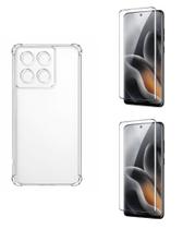 Kit Capa Tpu + 2 UN Película Curvada 3d Para Moto Edge 70 Fusion Kit Capa Tpu + 2 UN Película Curvada 3d Para Moto Edge 70 Fusion