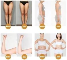 Kit com 30 unidades de adesivos slim para emagrecer.