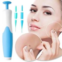 Kit Completo Removedor de Verrugas sem Dor - Auto Skin Tag Remover Kit
