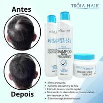 Kit Crescimento Difusão Capilar Tróia Hair 300 ml