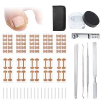 Kit de correção de unhas encravadas VOCOSTE Toe Nail Corrector Kit de correção de unhas encravadas VOCOSTE Toe Nail Corrector