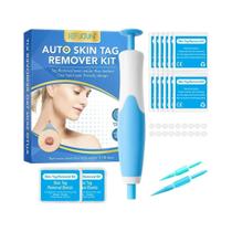 Kit De Remoção De Verrugas E Sinais Na Pele Facial, Ferramenta Automática De Remoção Com Microfitas