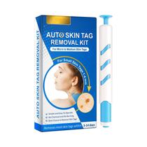 Kit De Remoção De Verrugas, Sinais E Acrocórdons Para Uso Doméstico Sem Dor, Tratamento De Acne,