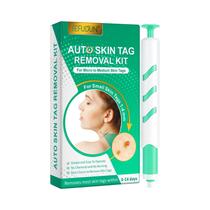 Kit De Remoção De Verrugas, Sinais E Acrocórdons Para Uso Doméstico Sem Dor, Tratamento De Acne Para