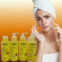 Kit Facial Antiacne Rhenuks Cosméticos 4 Produtos com Ácido Hialurônico e Vitamina A