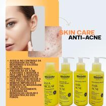 Kit Facial Rhenuks Anti-Acne 4 Itens - Rhenuks Kit Facial Rhenuks Anti-Acne 4 Itens - Rhenuks