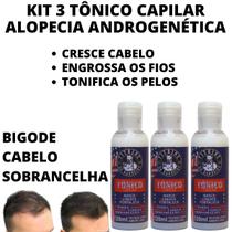 Kit Loção Anti Alopecia Androgenética Nasce Cresce Fortalece - Vitrine Do Barbeiro