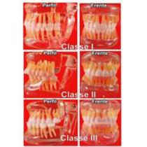 Kit Ortodôntico com 3 Modelos em Acrílico Transparente