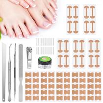 Kit para Remoção de Unha Encravada com Tiras Corretoras, Adesivo Curvo para Unhas, Lixa e Ferramentas de Pedicure para Mulheres e Homens