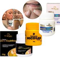 Kit Pomada Tira Mancha + Creme Zero Espinha + Pomada Micosan