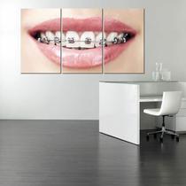 Kit Quadro Decorativo em MDF Para Dentista - Aparelho