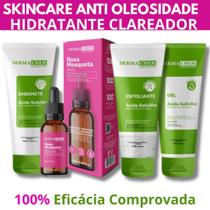 Kit Skincare Anti Oleosidade e Acne, Sérum Rosa Mosqueta Ultra Hidratante e Clareador EFICACIA COMPROVADA Dermachem 4ITENS