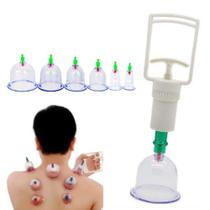 Kit ventosas terapeutica com bomba de succao e 6 copos para massoterapia terapia acuptura estetica - MAKEDA