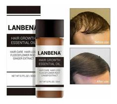 Lanbena Hair Essential Oil Mix de Ervas para Crescimento Lanbena Hair Essential Oil Mix de Ervas para Crescimento