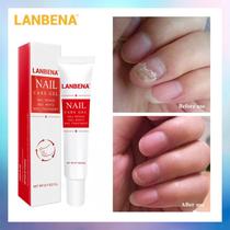 Lanbena Nail Care Gel Suporte para Unha Fraca e Lascada Lanbena Nail Care Gel Suporte para Unha Fraca e Lascada