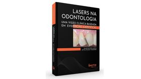 Lasers na Odontologia: Uma Visão Clínica Baseada em Evidências Científicas - Santos Publicações