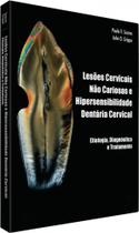 Lesões Cervicais não Cariosas e Hipersensibilidade Dentinária Cervical: Etiologia, Diag e Tratamento