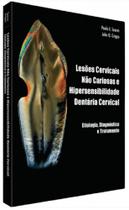 Lesoes Cervicais Nao Cariosas E Hipersensibilidade Dentinaria Cervical - QUINTESSENCE