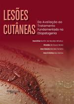 Lesões Cutâneas: Da Avaliação Ao Tratamento Fundamentado Na Etiopatogenia - DI LIVROS EDITORA LTDA Lesões Cutâneas: Da Avaliação Ao Tratamento Fundamentado Na Etiopatogenia - DI LIVROS EDITORA LTDA
