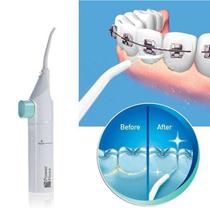 Limpador Dental A Jato Limpeza Irrigador Oral Bucal Dente Gengiva Boca Aparelho Fio Dental Água Manual
